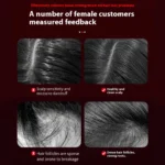 Electric Massage Comb 3 Modes Red Light - Image 5